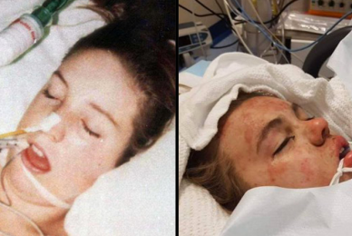 Tragic pics, taken 21 years apart, show dangers of ecstasy